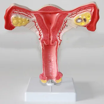 Анатомическая модель яичников и матки в акушерстве и гинекологии